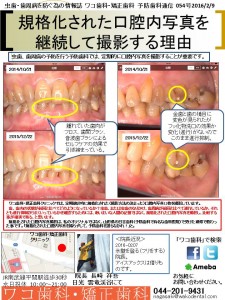わ　ワコ歯科・矯正歯科通信　001～100　2016-0130